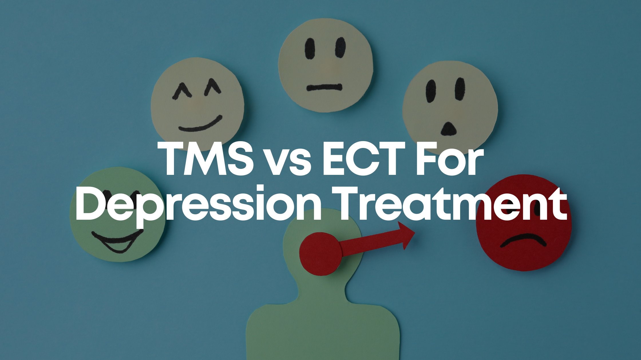You are currently viewing TMS vs ECT For Depression Treatment
